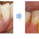 뉴플란트치과의원 이미지