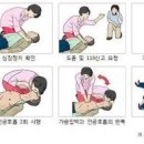 심장마비 전조증상 원인 치료 심장마비 사망 골든타임 심장마비 대처 예방 이미지