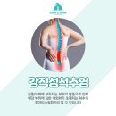 고릴라신경외과의원 이미지