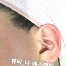 뷰티나에스테틱