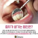 에스프라임 이미지