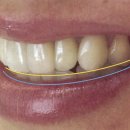 거성치과기공소 이미지