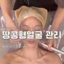 군자메디칼 | 군자역피부관리 오우시아 샤이닝리프팅으로 웨딩관리 준비한 후기