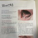 80일 아기 설소대단축증 시술후기(린소아과, 예약, 주차, 진료내용)