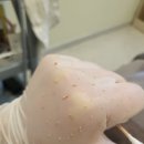 선수촌로L | 강릉여드름피부관리 강릉피부관리 강릉쥐젖제거 강릉사마귀제거 _ 다이아에스테틱