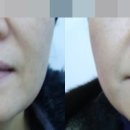 웰빙비뇨기과 네이버블로그