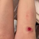 프로메딕스 | 25년 11월 말 홍콩여행 1일차