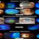 연세바른안과의원 이미지