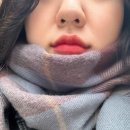 인생 첫 입술필러, 침샘 보톡스 드디어 해봤다! (사진있음)