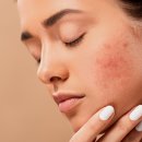 최성희SB발란스앤라인 이미지