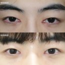 메이트성형외과