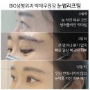 비아이오성형외과의원 | 눈꺼풀 처짐 눈썹리프팅&amp;상안검 비교 분석 및 수술 후기