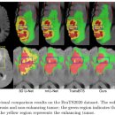 E1유도 | [jekim] Paper review