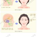 마비