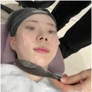(주)압구정하루 | 본식 직전 압구정 피부과 티타늄리프팅 내돈내산 관리 효과 및 통증 후기