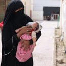 예멘: 급성 아동 영양실조가 치솟는 5가지 이유 이미지
