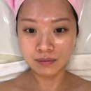 약초명가&스킨케어 | [천안] 백석동피부관리 잘하는 이정희 스킨케어, 약초 소프트필링 후기