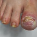 레푸스 감삼점&에이레네 이미지