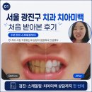 본치과 - 군포시 산본천로 43-58 | 서울 광진구 치과 치아미백처음 받아본 후기｜2년 만의 스케일링, 치아 시림은 괜찮았을까?