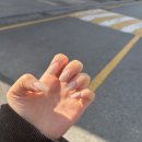 오르노네일