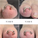 페디베네 이미지