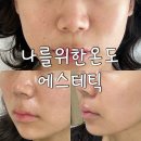 [나를위한온도 에스테틱] 가좌동 에스테틱 | 모공 관리, 홍조 개선 , 마이크로젯 관리 후기