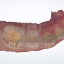 세일치과기공소 네이버블로그