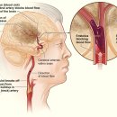 경희강추한의원 이미지