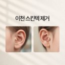 (주)이천텍 - 군산시 성산면 | (주)이천텍