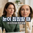안구건조증 관리법과 아이봉 사용 후기, 눈 세정 습관의 변화