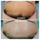 비채라인