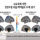 단월드 브레인명상] 전전두엽 피질, 백색질 두께 증가 이미지