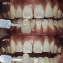 바른뿌리치과의원 이미지