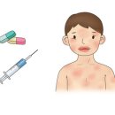 약물 알레르기[drug allergy] 이미지