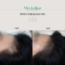 모뜰리에