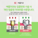 애플치과기공소 이미지