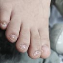 라라약국 | 노원문제성케어 라라뷰티｜아이 발톱도 안심하고 맡긴 솔직 후기