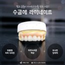 예쁜치아디자인치과기공소 이미지