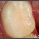 서울엘리트치과의원 이미지