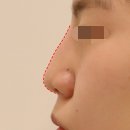 하이코코 이미지