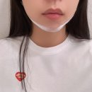 비너스치과의원 네이버블로그