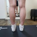 바디힐주 | 청담피부과 종아리하이힐주사 효과 본 솔직 후기(효과,멍,붓기)