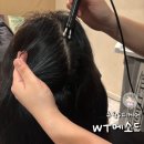 21세기미 | 수원두피케어 | 국내 최초 두피, 탈모 전문센터 WT메소드 수원영통점 방문 후기
