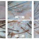 강남뷰티의원 이미지