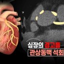 힐더바디