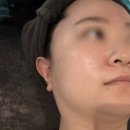 3403 | 대전 둔산동 에스테티아 대전타임월드점 윤곽관리 후기