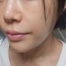 수지장갑 | 용인 피부 관리 샵 추천, 솔에스테틱 용인수지점 수분진정 앰플관리 후기