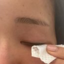 비젼 | 마이봄샘 관리 필수템 눈꺼풀세정제 아큐비젼 리얼후기