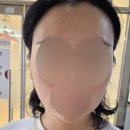 투유피부관리 | 천안 불당동 피부관리 윤곽관리 티리온-X 얼굴 반쪽된 후기 뷰티투유