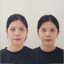 평거강변1 - B (우측) | 하남체형관리로 얼굴비대칭관리하는전문점 &#39;몸다움체형교정&#39; 방문 후기!